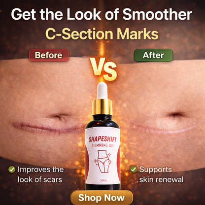 Shape Shift Slimming Oil